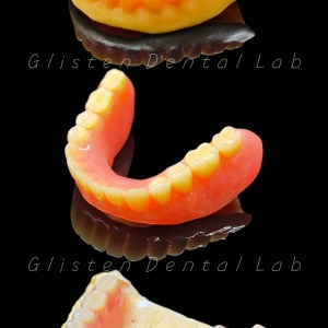 Why copy denture/duplicated denture becomes more and more popular